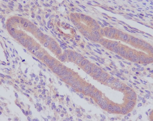 Caspase-8 Rabbit mAb