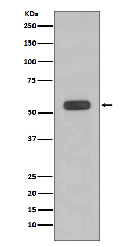 Caspase-8 Rabbit mAb