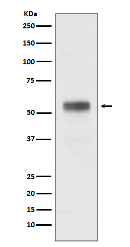 Retinoic Acid Receptor alpha Rabbit mAb