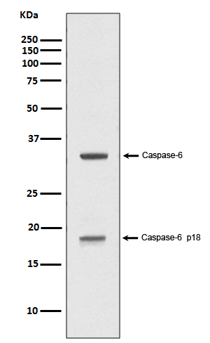 Caspase-6 p18 Rabbit mAb