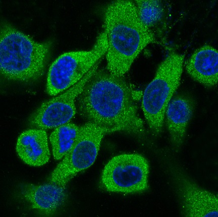 Cytokeratin 18 Rabbit mAb