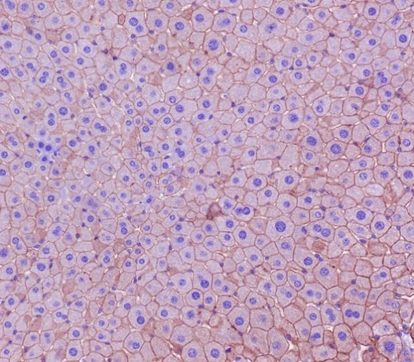 Cytokeratin 18 Rabbit mAb