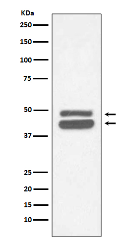 Cytokeratin 18 Rabbit mAb