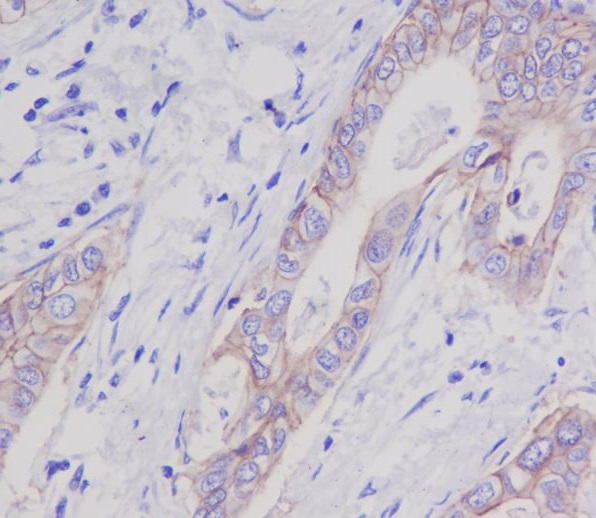 EpCAM Rabbit mAb