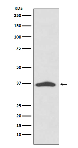 EpCAM Rabbit mAb