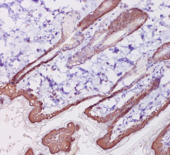 Cytokeratin 1 Rabbit mAb