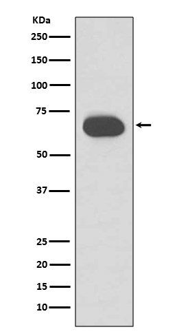 Cytokeratin 1 Rabbit mAb