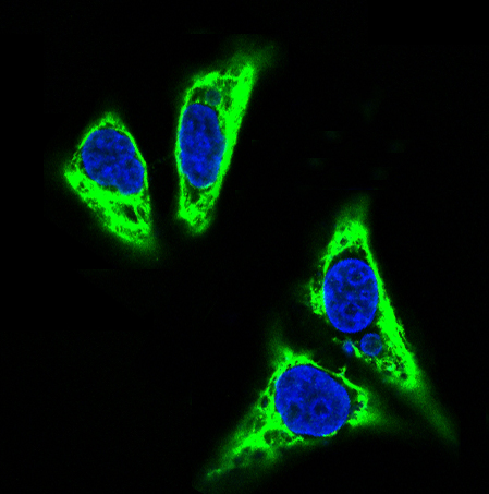 TNFAIP3 Rabbit mAb