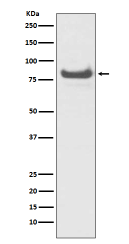 TNFAIP3 Rabbit mAb