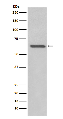 RelB Rabbit mAb