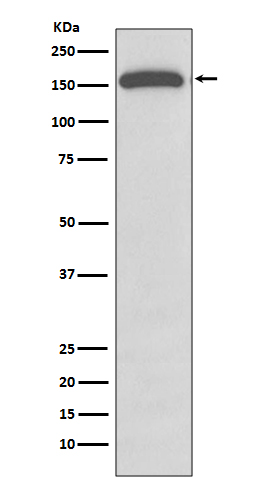 Gli1 Rabbit mAb