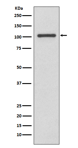 INPP4B Rabbit mAb