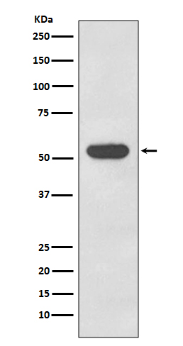 Cytokeratin 4 Rabbit mAb