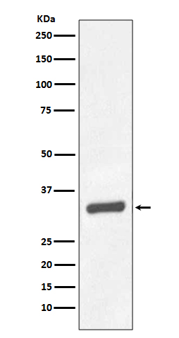 PSA/KLK3 Rabbit mAb