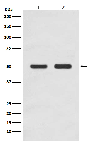 AP2M1 Rabbit mAb