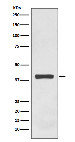 AMPK gamma 1 Rabbit mAb