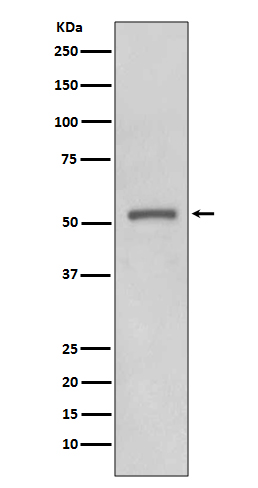 MMP11 Rabbit mAb