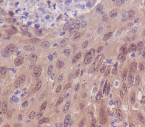 IRF3 Rabbit mAb