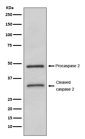 Caspase-2 Rabbit mAb