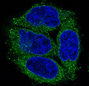 Cytokeratin 7 Rabbit mAb