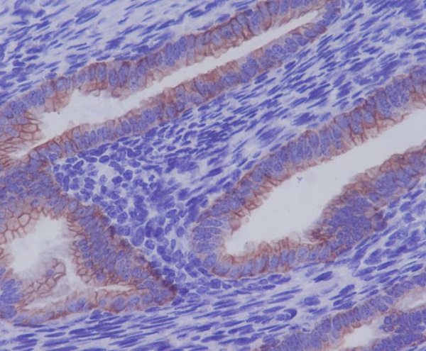 Cytokeratin 7 Rabbit mAb