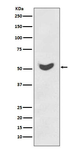 Cytokeratin 7 Rabbit mAb