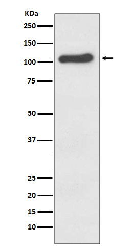 ACE2 Rabbit mAb