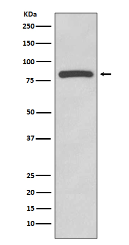 Glycogen synthase Rabbit mAb