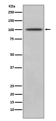 CD10 Rabbit mAb