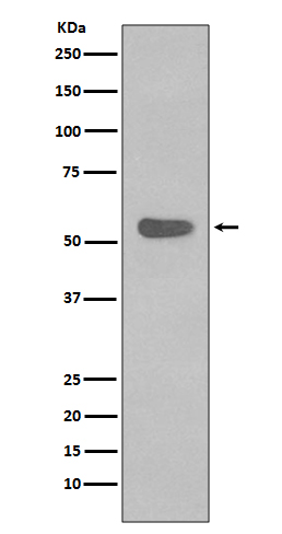 Cytokeratin 4 Rabbit mAb