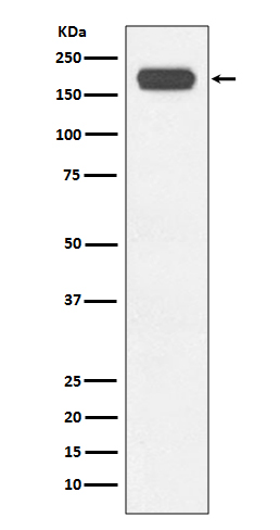 BRG1 Rabbit mAb