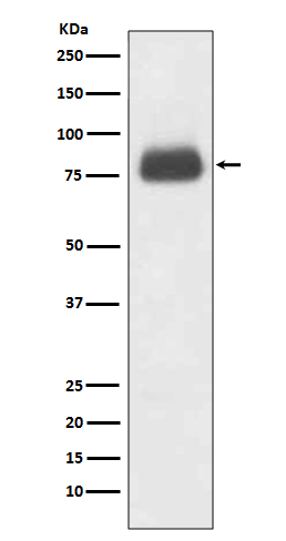 CD36 Rabbit mAb