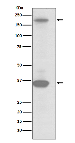 RON Rabbit mAb