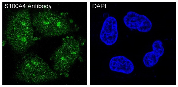 S100A4 Rabbit mAb