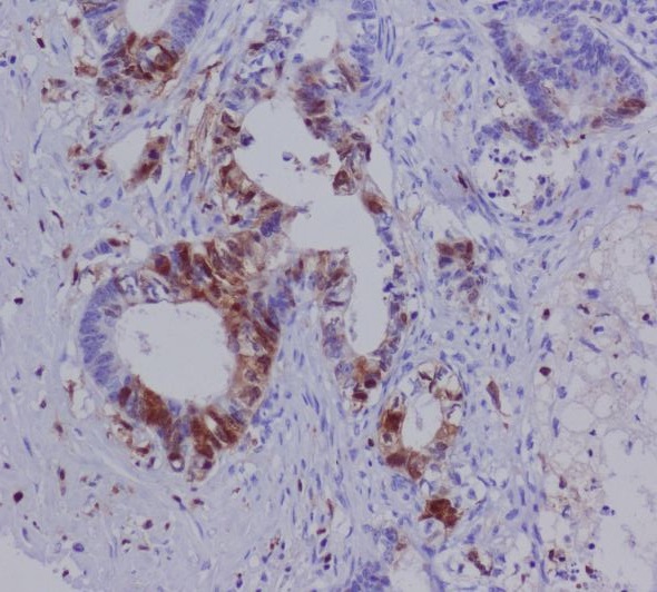 S100A4 Rabbit mAb