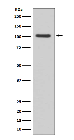 GluR1 Rabbit mAb