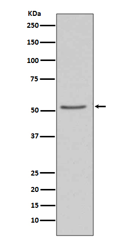 Angiotensinogen Rabbit mAb