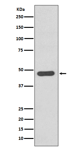 Tissue Factor Rabbit mAb