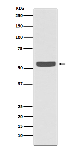 Cytokeratin 2e Rabbit mAb