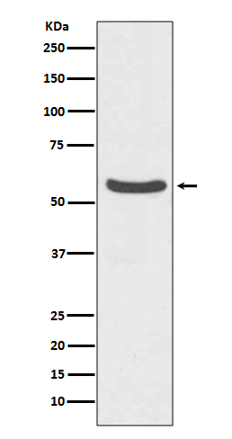 GLUT2 Rabbit mAb