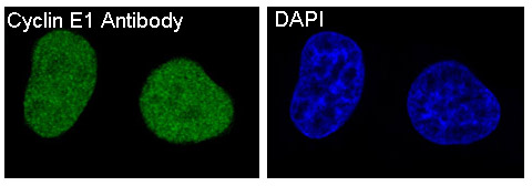 Cyclin E1 Rabbit mAb