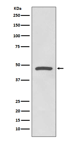 Cyclin E1 Rabbit mAb