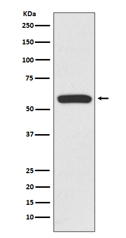 IRF6 Rabbit mAb