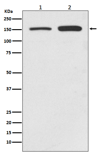 SMC1 Rabbit mAb