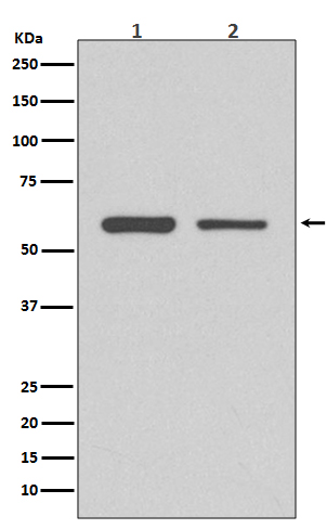 CDK8 Rabbit mAb