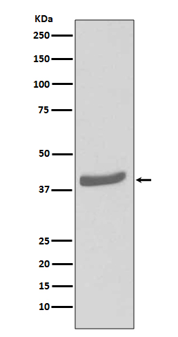 CDK7 Rabbit mAb