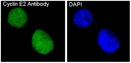 Cyclin E2 Rabbit mAb