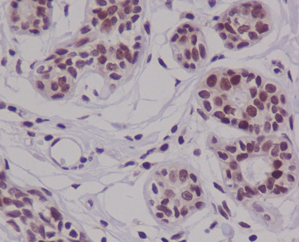 Cyclin E2 Rabbit mAb