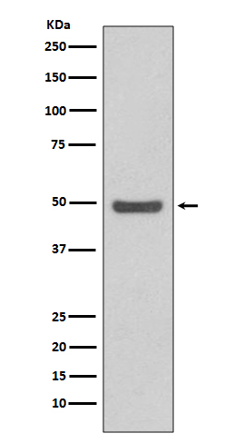 Cyclin E2 Rabbit mAb