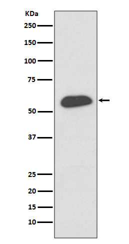 IRF5 Rabbit mAb